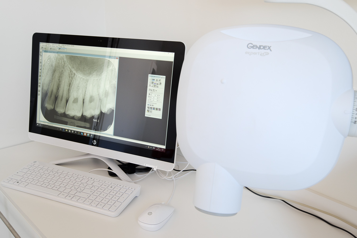 At the dentist: a computer screen displaying  a dental x-ray image together with the x-ray machine that created it